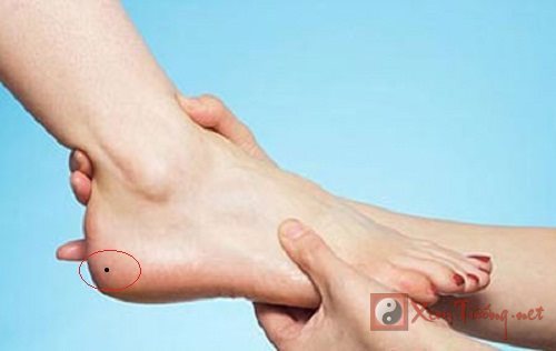 Nốt ruồi ở gót chân phải có ý nghĩa gì?